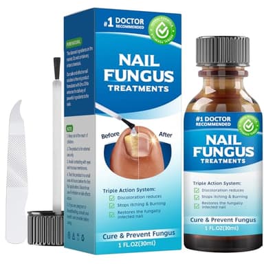 Antimicotico Unghie Piedi,Trattamento Antimicotico Extra Forte per Micosi Unghie Piedi e Mani – Azione Rapida 48h, Risultati Visibili | Liquido Antifungino 30 ml