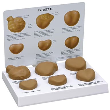 GPI Anatomicals W33366 Modello di Prostata